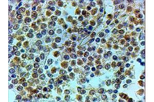 ABIN2560562 (4µg/ml) staining of paraffin embedded Human Spleen. (LRRFIP1 anticorps  (C-Term))