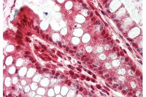 Rabbit Anti-RNF10 antibody  Formalin Fixed Paraffin Embedded Tissue: Human Colon Primary antibody Concentration: 1:100 Secondary Antibody: Donkey anti-Rabbit-Cy3 Secondary Antibody Concentration: 1:200 Magnification: 20x Exposure Time: 0.