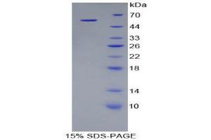 SDS-PAGE (SDS) image for Kallikrein 8 (KLK8) (AA 34-260) protein (His tag,GST tag) (ABIN1879806)