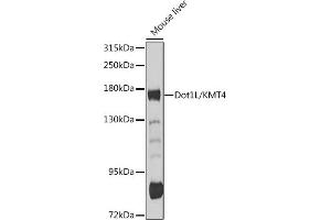 Western blot analysis of extracts of mouse liver, using Dot1L/KMT4 antibody (ABIN6130310, ABIN6139773, ABIN6139777 and ABIN6215149) at 1:1000 dilution. (DOT1L anticorps  (AA 1-250))