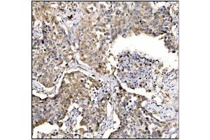 IHC analysis of Caspase-9/CASP9 using anti-Caspase-9/CASP9 antibody (ABIN7600340). (Caspase 9 anticorps  (AA 18-416))