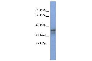 WB Suggested Anti-RBM9  Antibody Titration: 0. (RBM9 anticorps  (Middle Region))