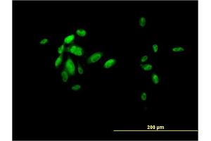 Immunofluorescence of monoclonal antibody to FOXA2 on HepG2 cell. (FOXA2 anticorps  (AA 363-457))