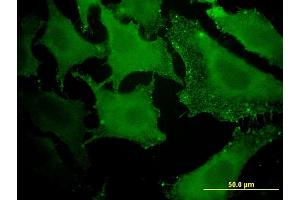 Immunofluorescence of monoclonal antibody to ACAA1 on HeLa cell.