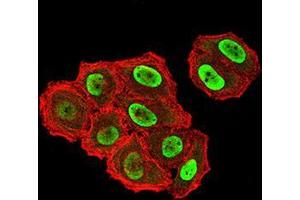 Immunofluorescence analysis of Hela cells using ZFP91 mouse mAb (green).