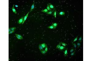 IF analysis of FHL using anti-FHL antibody (ABIN7600488). (FHL1 anticorps  (AA 2-323))