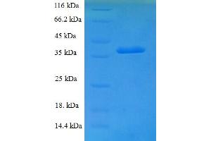 SDS-PAGE (SDS) image for Glucosamine-6-Phosphate Deaminase 1 (GNPDA1) (AA 1-289), (full length) protein (His tag) (ABIN5709599)