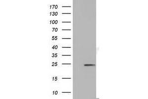 Western Blotting (WB) image for anti-MOB Kinase Activator 3B (MOB3B) antibody (ABIN1499539) (MOBKL2B anticorps)
