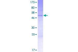 Image no. 1 for Suprabasin (SBSN) (AA 1-247) protein (GST tag) (ABIN1319189)
