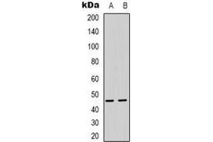 Western blot analysis of PSMD11 expression in Hela (A), HEK293T (B) whole cell lysates. (PSMD11 anticorps)