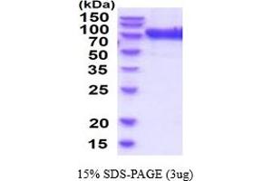 SDS-PAGE (SDS) image for Glucuronidase, beta (GUSB) (AA 23-651) (Active) protein (His tag) (ABIN7529348)
