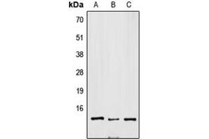 Western blot analysis of SNRPD3 expression in Jurkat (A), mouse brain (B), H9C2 (C) whole cell lysates. (SNRPD3 anticorps  (Center))