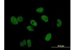 Immunofluorescence of purified MaxPab antibody to TERF1 on HeLa cell.