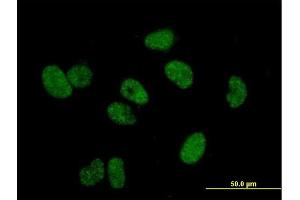 Immunofluorescence of purified MaxPab antibody to TERF1 on HeLa cell.