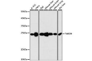Western blot analysis of extracts of various cell lines, using TMED9 antibody.