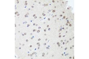 Immunohistochemistry of paraffin-embedded rat brain using S antibody (ABIN1682621, ABIN3018891, ABIN3018892 and ABIN6220612) at dilution of 1:100 (40x lens).