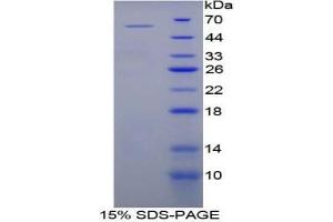 SDS-PAGE analysis of Mouse bACE2 Protein. (BACE2 Protéine)