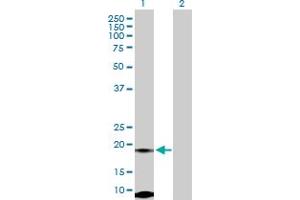 Western Blot analysis of FUNDC2 expression in transfected 293T cell line by FUNDC2 MaxPab polyclonal antibody. (FUNDC2 anticorps  (AA 1-189))