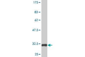 Western Blot detection against Immunogen (32.