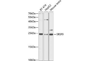 Western blot analysis of extracts of various cell lines, using SRSF9 antibody (ABIN6132650, ABIN6147681, ABIN6147684 and ABIN6216200) at 1:1000 dilution. (SFRS9 anticorps  (AA 1-221))