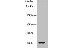 Western blot All lanes: ZBTB8OS antibody at 8 μg/mL + HL60 whole cell lysate Secondary Goat polyclonal to rabbit IgG at 1/10000 dilution Predicted band size: 20, 16 kDa Observed band size: 20 kDa