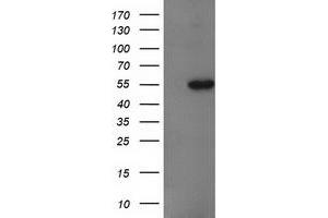 Western Blotting (WB) image for anti-Glucosidase, Beta, Acid 3 (Cytosolic) (GBA3) (AA 1-150), (AA 370-469) antibody (ABIN1490584)