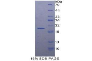 SDS-PAGE (SDS) image for Colony Stimulating Factor 2 Receptor, Alpha, Low-Affinity (Granulocyte-Macrophage) (CSF2RA) (AA 204-360) protein (His tag) (ABIN1877584) (CSF2RA Protein (AA 204-360) (His tag))