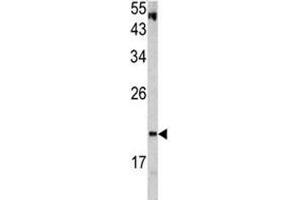 Western blot analysis of VHL antibody and HepG2 lysate.