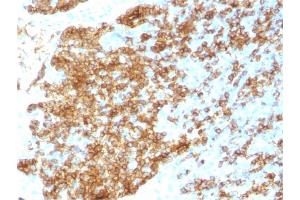 Formalin-fixed, paraffin-embedded human Tonsil stained with CD45RB Rabbit Recombinant Monoclonal Antibody (PTPRC/1783R). (Recombinant CD45 anticorps)