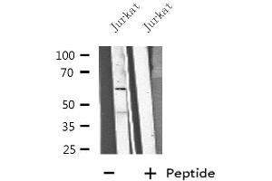 Western blot analysis of extracts from Jurkat cells, using CP1B1 antibody. (CYP1B1 anticorps  (Internal Region))