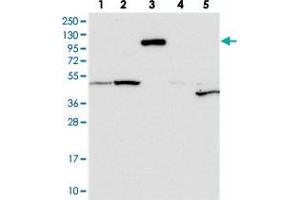 Western blot analysis of Lane 1: RT-4, Lane 2: U-251 MG, Lane 3: Human Plasma, Lane 4: Liver, Lane 5: Tonsil with CNTN5 polyclonal antibody  at 1:250-1:500 dilution. (Contactin 5 anticorps)