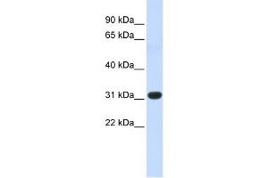 WB Suggested Anti-HOXC8 Antibody Titration: 1 ug/ml Positive Control: Fetal Muscle cell lysate (HOXC8 anticorps  (N-Term))