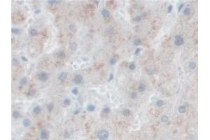 Detection of PCSK1 in Human Liver Tissue using Polyclonal Antibody to Proprotein Convertase Subtilisin/Kexin Type 1 (PCSK1)