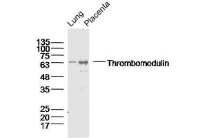 Lane 1: Lung lysates Lane 2: Placenta lysates probed with Thrombomodulin Polyclonal Antibody, Unconjugated  at 1:300 dilution and 4˚C overnight incubation. (Thrombomodulin anticorps  (AA 21-120))