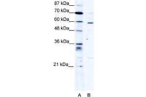 WB Suggested Anti-PDLIM5 Antibody Titration:  1. (PDLIM5 anticorps  (Middle Region))