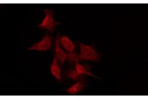 ABIN6276019 staining Hela by IF/ICC. (GPR158 anticorps  (N-Term))