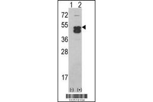 Western blot analysis of CAMK1D using CAMK1D (CAMK1 delta)Antibody using 293 cell lysates (2 ug/lane) either nontransfected (Lane 1) or transiently transfected with the CAMK1D gene (Lane 2). (CAMK1D anticorps  (C-Term))