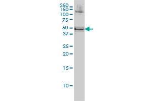 RBMS1 monoclonal antibody (M02), clone M1 Western Blot analysis of RBMS1 expression in HeLa .