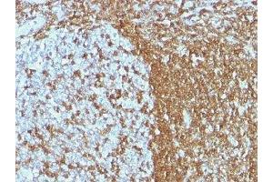 Formalin-fixed, paraffin-embedded human tonsil stained with ICAM3 antibody (ICAM3/1019) (ICAM-3/CD50 anticorps)
