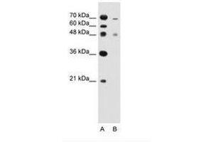 Image no. 1 for anti-Zinc Finger, FYVE Domain Containing 27 (ZFYVE27) (C-Term) antibody (ABIN205048) (ZFYVE27 anticorps  (C-Term))