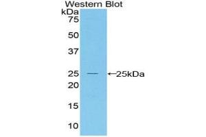 Detection of Recombinant Bax, Mouse using Polyclonal Antibody to Bcl2 Associated X Protein (Bax) (BAX anticorps  (AA 1-158))