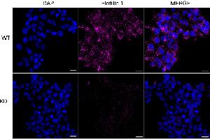 Immunocytochemical staining of HeLa cells using Flotillin 1 antibody (ABIN7798631), 1:1,000), Top panel: wild-type (WT), Bottom panal: Flotillin 1 shRNA knockdown (KD).