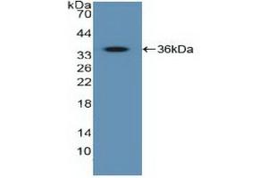 Detection of Recombinant IGF2R, Human using Polyclonal Antibody to Insulin Like Growth Factor 2 Receptor (IGF2R) (IGF2R anticorps  (AA 2167-2442))