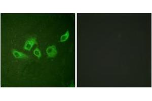 Immunofluorescence analysis of HuvEc cells, using CrkII (Phospho-Tyr221) Antibody. (Crk anticorps  (pTyr221))