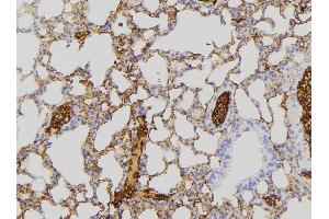 ABIN6275271 at 1/100 staining Mouse lung tissue by IHC-P.