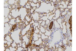 ABIN6275271 at 1/100 staining Mouse lung tissue by IHC-P. (NDUFA8 anticorps  (Internal Region))