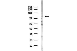 Western blot analysis of lysates from EC304 cells(heat-shock,45 min treatment), using TBX 2/3 Antibody at 1/1000 dilution. (TBX2/3 (Internal Region) anticorps)