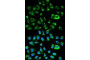 Immunofluorescence analysis of HeLa cell using GAS2 antibody. (GAS2 anticorps  (AA 1-100))