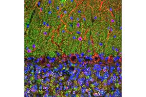 Confocal image of adult rat cerebellum stained with ABIN1580472 (green), ’s chicken polyclonal antibody to MAP2 CPCA-MAP2 (red) and DNA (blue). (VSNL1 anticorps)