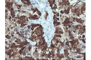 Image no. 1 for anti-Cellular Retinoic Acid Binding Protein 2 (CRABP2) antibody (ABIN1497620)